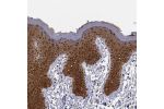 Immunohistochemical staining of human skin shows strong cytoplasmic positivity in squamous epithelial cells.