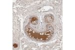 Immunohistochemical staining of human epididymis shows strong positivity in plasma in blood vessels.