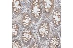 Immunohistochemical staining of human gastrointestinal shows moderate cytoplasmic positivity in glandular cells.