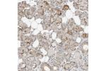 Immunohistochemical staining of human salivary gland shows moderate cytoplasmic positivity in few glandular cells.