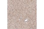 Immunohistochemical staining of human cerebral cortex shows moderate positivity in neuronal processes.