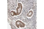Immunohistochemical staining of human endometrium shows moderate to strong nuclear positivity in glandular cells.