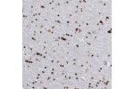 Immunohistochemical staining of human cerebral cortex shows strong nuclear positivity in neurons.