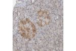 Immunohistochemical staining of human pancreas shows moderate cytoplasmic positivity in islets of Langerhans.
