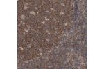 Immunohistochemical staining of human tonsil shows strong cytoplasmic positivity in germinal center cells.
