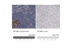 Immunohistochemistry analysis in human lymph node and liver tissues using HPA024205 antibody. Corresponding KIF18B RNA-seq data are presented for the same tissues.