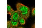 Immunofluorescent staining of human cell line A-431 shows localization to nucleoplasm & cytosol.