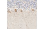 Immunohistochemical staining of human cerebellum shows moderate cytoplasmic positivity in Purkinje cells.