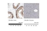 Immunohistochemistry analysis in human testis and pancreas tissues using Anti-DNAJB6 antibody. Corresponding DNAJB6 RNA-seq data are presented for the same tissues.