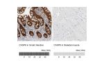 Immunohistochemistry analysis in human small intestine and skeletal muscle tissues using Anti-CASP6 antibody. Corresponding CASP6 RNA-seq data are presented for the same tissues.