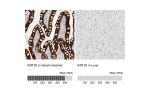 Immunohistochemistry analysis in human small intestine and liver tissues using HPA024309 antibody. Corresponding KRT20 RNA-seq data are presented for the same tissues.