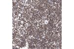 Immunohistochemical staining of human lymph node shows strong nuclear positivity in lymphoid cells.