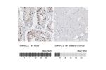 Immunohistochemistry analysis in human testis and skeletal muscle tissues using HPA024352 antibody. Corresponding SMARCC1 RNA-seq data are presented for the same tissues.