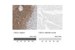 Immunohistochemistry analysis in human spleen and skeletal muscle tissues using HPA024353 antibody. Corresponding CD22 RNA-seq data are presented for the same tissues.