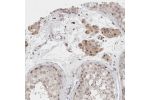 Immunohistochemical staining of human testis shows strong nuclear positivity in Leydig cells.