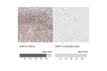 Immunohistochemistry analysis in human tonsil and cerebral cortex tissues using Anti-IKZF3 antibody. Corresponding IKZF3 RNA-seq data are presented for the same tissues.
