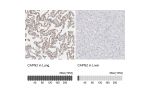 Immunohistochemistry analysis in human lung and liver tissues using HPA024470 antibody. Corresponding CAPN2 RNA-seq data are presented for the same tissues.