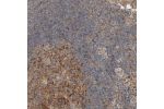 Immunohistochemical staining of human Lymph node shows moderate cytoplasmic positivity in germinal center cells.