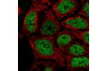 Immunofluorescent staining of human cell line CACO-2 shows localization to nucleoplasm.