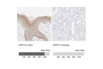 Immunohistochemistry analysis in human skin and kidney tissues using HPA024554 antibody. Corresponding KRT15 RNA-seq data are presented for the same tissues.