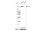 Western blot analysis in HEK293 cells transfected with control siRNA, target specific siRNA probe #1, using Anti-NUP205 antibody. Remaining relative intensity is presented. Loading control: Anti-GAPDH.