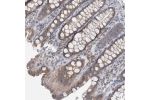 Immunohistochemical staining of human colon shows moderate cytoplasmic positivity in glandular cells.