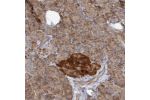 Immunohistochemical staining of human pancreas shows strong cytoplasmic positivity in islets of Langerhans.