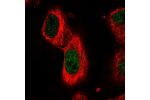 Immunofluorescent staining of human cell line U-251 MG shows localization to nucleoplasm.