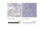Immunohistochemistry analysis in human testis and tonsil tissues using HPA024629 antibody. Corresponding KLF17 RNA-seq data are presented for the same tissues.