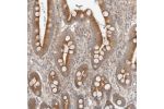 Immunohistochemical staining of human duodenum shows strong cytoplasmic positivity in glandular cells.