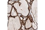 Immunohistochemical staining of human thyroid gland shows strong cytoplasmic positivity in glandular cells.