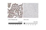 Immunohistochemical staining of human bone marrow shows strong nuclear positivity in bone marrow poietic cells.