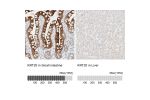Immunohistochemistry analysis in human small intestine and liver tissues using HPA024684 antibody. Corresponding KRT20 RNA-seq data are presented for the same tissues.