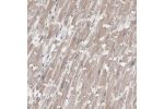 Immunohistochemical staining of human heart muscle shows moderate cytoplasmic positivity in cardiomyocytes.