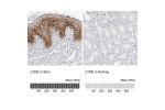 Immunohistochemistry analysis in human skin and kidney tissues using HPA024755 antibody. Corresponding LY6D RNA-seq data are presented for the same tissues.