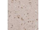 Immunohistochemical staining of human urinary bladder shows strong cytoplasmic positivity in urothelial cells.