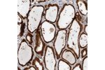 Immunohistochemical staining of human thyroid gland shows strong cytoplasmic positivity in glandular cells.