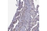 Immunohistochemical staining of human stomach shows moderate cytoplasmic positivity in glandular cells.