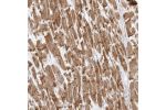 Immunohistochemical staining of human Heart muscle shows strong cytoplasmic positivity in cardiomyocytes and intercalated disks.