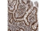 Immunohistochemical staining of human duodenum shows strong nuclear positivity in glandular cells.