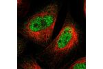 Immunofluorescent staining of human cell line U-2 OS shows localization to nucleoplasm.