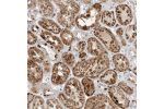 Immunohistochemical staining of human kidney shows strong granular cytoplasmic positivity in cells in tubules.