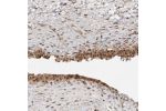 Immunohistochemical staining of human urinary bladder shows nuclear and cytoplasmic positivity in urothelial cells.