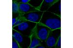 Immunofluorescent staining of MCF7 cells shows localization to plasma membrane.
