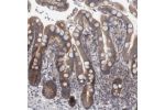Immunohistochemical staining of human colon shows moderate positivity in glandular cells.