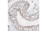 Immunohistochemical staining of human testis shows moderate nuclear and cytoplasmic positivity in cells in seminiferous ducts.