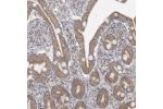 Immunohistochemical staining of human duodenum shows moderate cytoplasmic positivity in glandular cells.