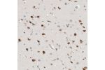 Immunohistochemical staining of human kidney shows strong nuclear positivity in cells in tubules and cells in glomeruli.
