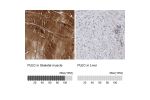 Immunohistochemistry analysis in human skeletal muscle and liver tissues using HPA025967 antibody. Corresponding PLEC RNA-seq data are presented for the same tissues.