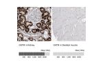 Immunohistochemistry analysis in human kidney and skeletal muscle tissues using HPA026077 antibody. Corresponding GATM RNA-seq data are presented for the same tissues.